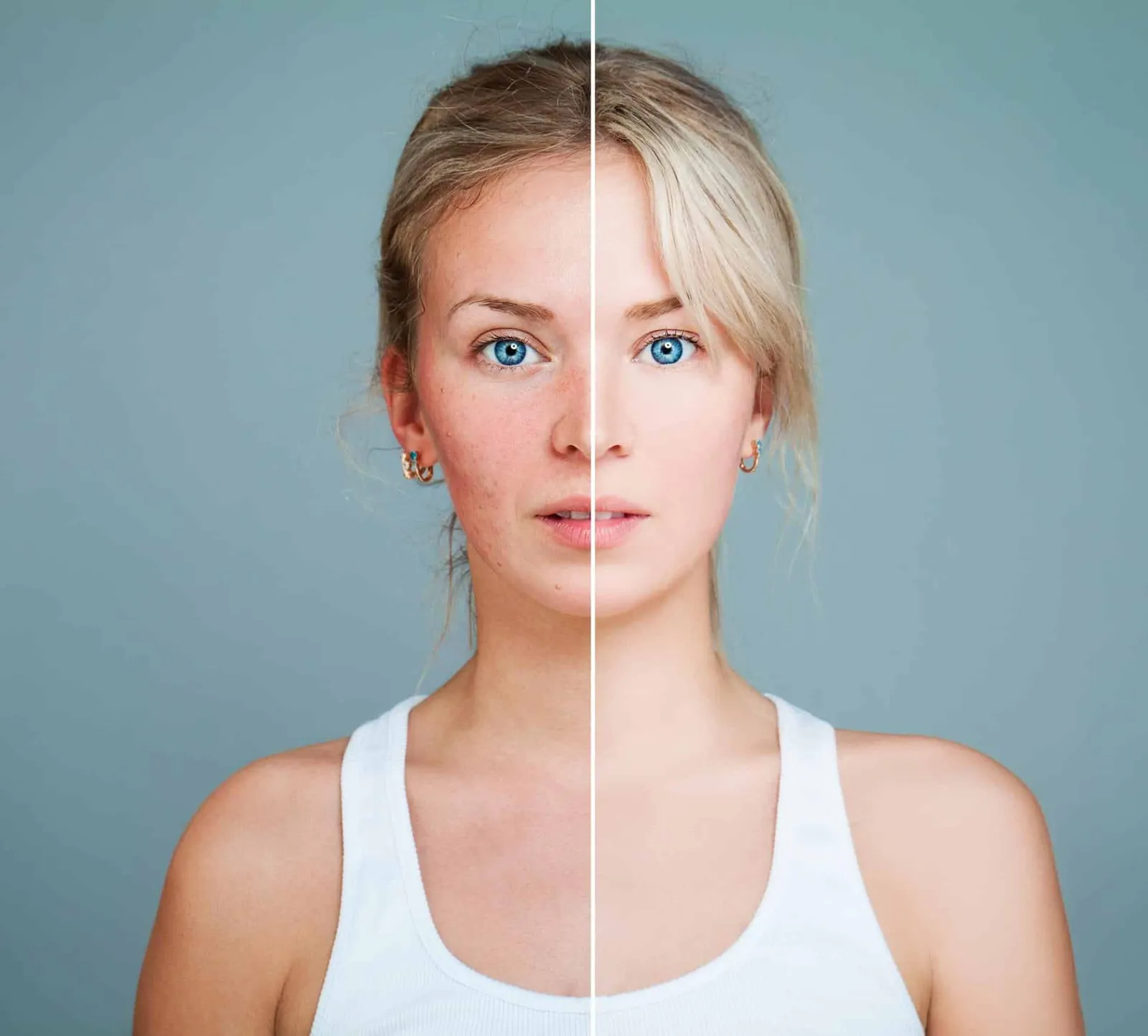 Comment traiter les rougeurs au visage ?