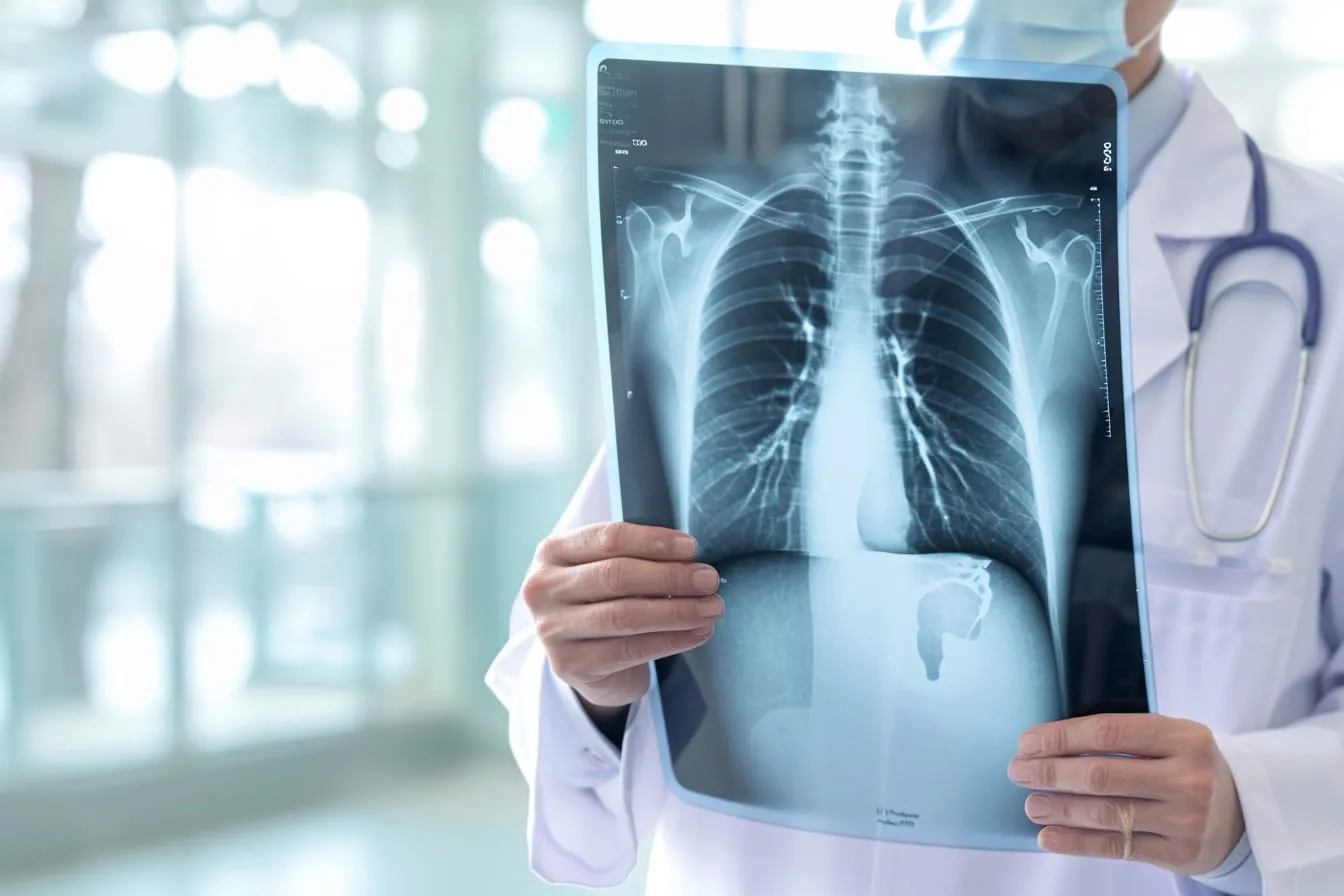 Comprendre l’épanchement pleural : causes et traitements de l’accumulation d’eau dans la plèvre
